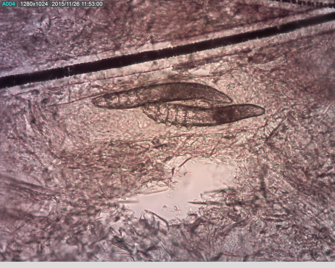 Demodex im Mikroskop